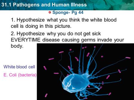 31.1 Pathogens and Human Illness Sponge- Pg 44 1. Hypothesize what you think the white blood cell is doing in this picture. 2. Hypothesize why you do not.