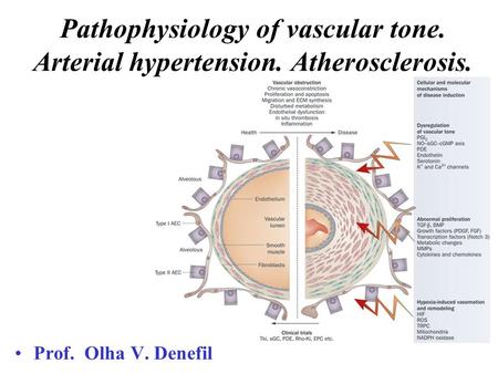 Pathophysiology of vascular tone. Arterial hypertension. Atherosclerosis. Prof. Olha V. Denefil.