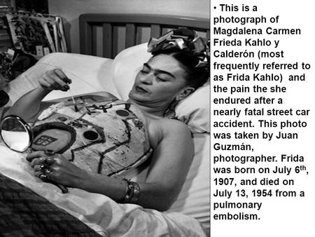 This is a photograph of Magdalena Carmen Frieda Kahlo y Calderón (most frequently referred to as Frida Kahlo) and the pain the she endured after a nearly.