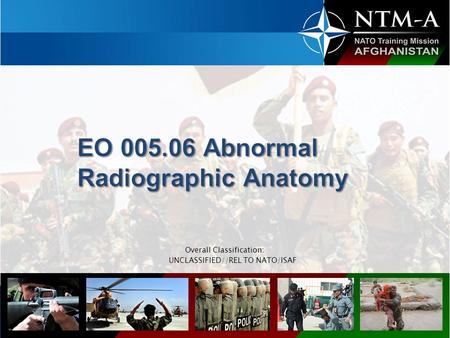 EO Abnormal Radiographic Anatomy