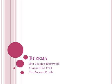 E CZEMA By: Jessica Kurzweil Class: EEC 4731 Professor: Towle.