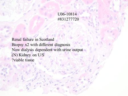 U06-10814 #831277720 Renal failure in Scotland Biopsy x2 with different diagnosis Now dialysis dependent with urine output (N) Kidney on U/S ?viable tissue.