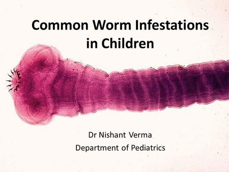 Common Worm Infestations in Children Dr Nishant Verma Department of Pediatrics.