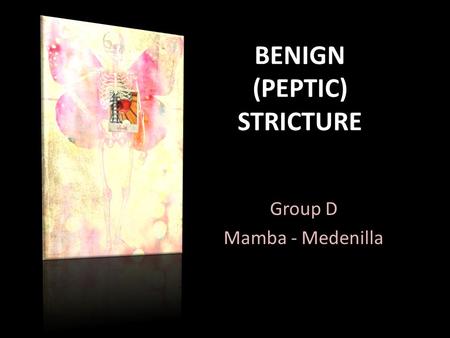 BENIGN (PEPTIC) STRICTURE Group D Mamba - Medenilla.
