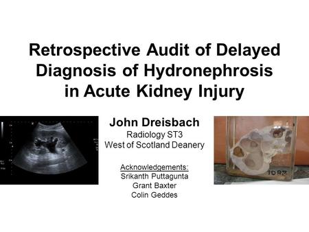 Retrospective Audit of Delayed Diagnosis of Hydronephrosis in Acute Kidney Injury John Dreisbach Radiology ST3 West of Scotland Deanery Acknowledgements: