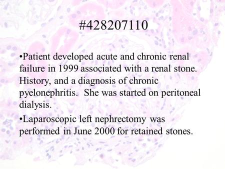Patient developed acute and chronic renal failure in 1999 associated with a renal stone. History, and a diagnosis of chronic pyelonephritis. She was started.
