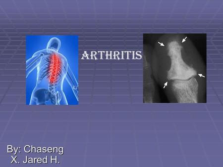 By: Chaseng X. Jared H. Arthritis. Nutrition Essential Questions  We learned that there are hundreds of kinds of arthritis diseases  It doesn’t take.