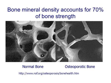 Bone mineral density accounts for 70% of bone strength