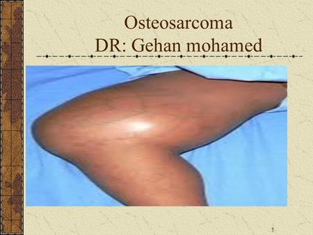 Osteosarcoma DR: Gehan mohamed 1. 10/5/20152 Osteosarcoma.
