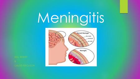 WILL REBERT & CHLOE FERGUSON Meningitis. Definition  It is an infection and inflammation of the fluid and membranes protecting the brain and spinal.