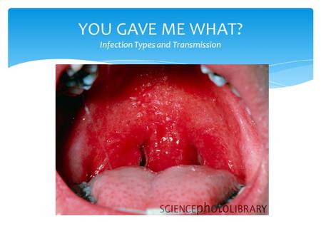 YOU GAVE ME WHAT? Infection Types and Transmission