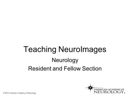 Teaching NeuroImages Neurology Resident and Fellow Section © 2013 American Academy of Neurology.