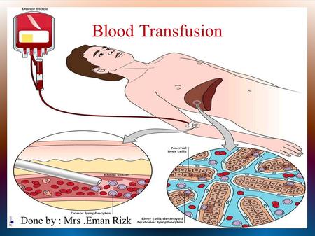 Blood Transfusion Done by : Mrs.Eman Rizk. Definition ( Blood Transfusion ) Is the process of transferring blood or blood-based products from one person.