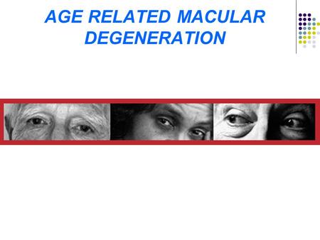AGE RELATED MACULAR DEGENERATION. AMD epidemic of aging Prediction by United Nations 606 million over age 60 in 2000 will go to 2 billion by 2050 Population.
