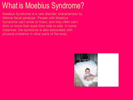 Moebius Syndrome is a rare disorder characterized by lifetime facial paralysis. People with Moebius Syndrome can’t smile or frown, and they often can’t.