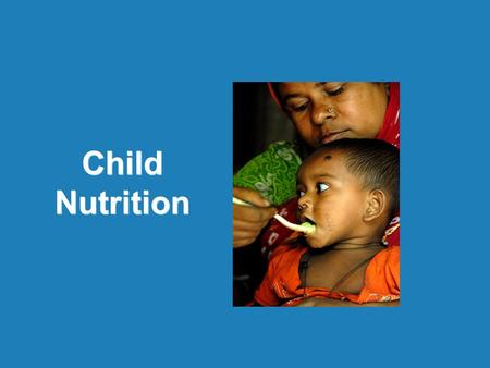 Child Nutrition. Child Nutrition | MGIMS, Sewagram | 31 st Oct 2012 Clinical assessment –Obvious wasting, Edema Anthropometric measurements Biochemical.
