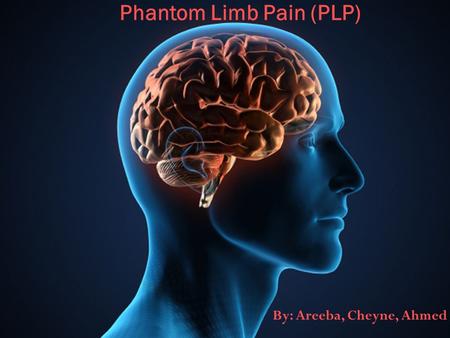 By: Areeba, Cheyne, Ahmed Phantom Limb Pain (PLP).
