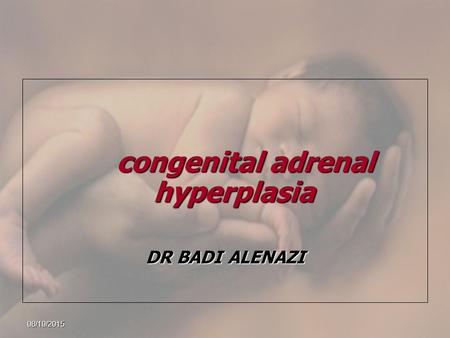 08/10/2015 congenital adrenal hyperplasia congenital adrenal hyperplasia DR BADI ALENAZI.