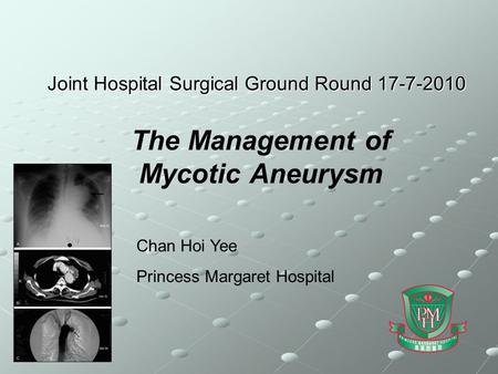 Joint Hospital Surgical Ground Round 17-7-2010 The Management of Mycotic Aneurysm Chan Hoi Yee Princess Margaret Hospital.