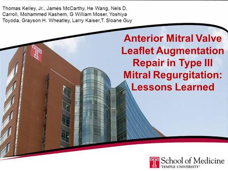 Anterior Mitral Valve Leaflet Augmentation Repair in Type III Mitral Regurgitation: Lessons Learned Thomas Kelley, Jr., James McCarthy, He Wang, Nels D.