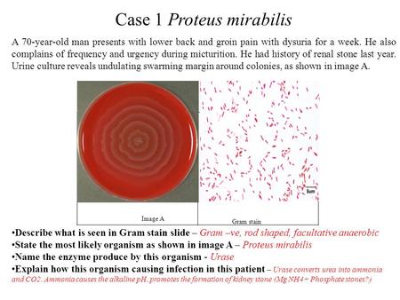 Case 1 Proteus mirabilis Image A Gram stain slide A 70-year-old man presents with lower back and groin pain with dysuria for a week. He also complains.