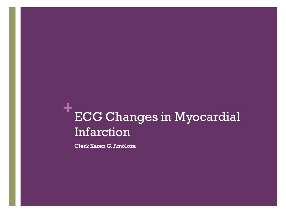 myocardial infarction ecg interpretation