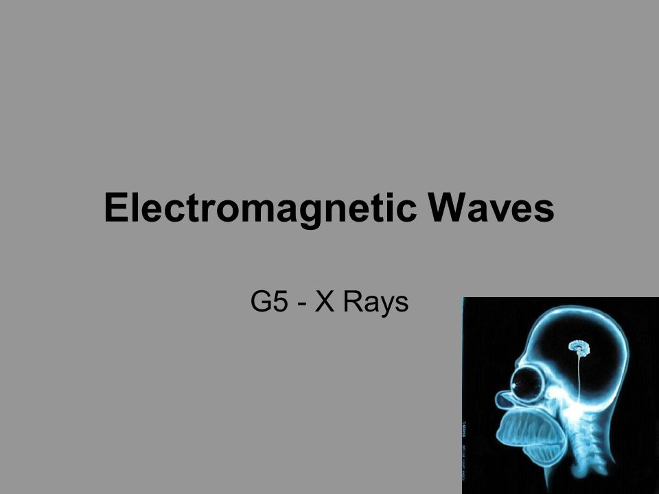 Electromagnetic Waves G5 X Rays Coolidge Tube X Ray Tube K Hot Filament Cathode A Tungsten Anode U H Heater Voltage E G 12v U A Accelerating Ppt Download