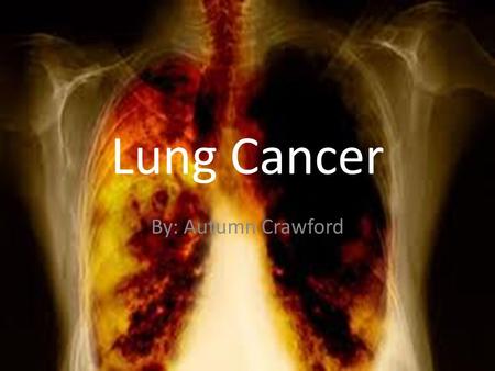 Lung Cancer By: Autumn Crawford. Symptoms Many people dismiss or adapt to a chronic cough, attributing it to something else. It is just allergies, a cough.