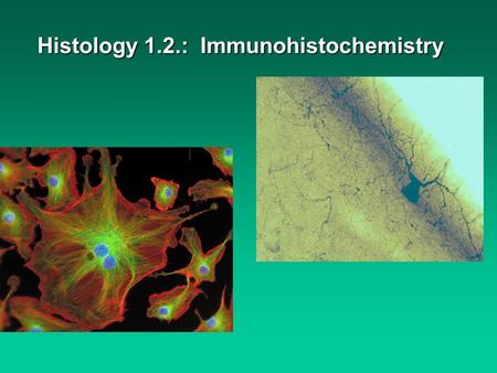 Histology 1.2.: Immunohistochemistry. Immunohistochemistry uses the principle of immunity: During development the immune system recognizes foreignDuring.