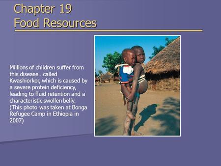 Chapter 19 Food Resources Millions of children suffer from this disease…called Kwashiorkor, which is caused by a severe protein deficiency, leading to.