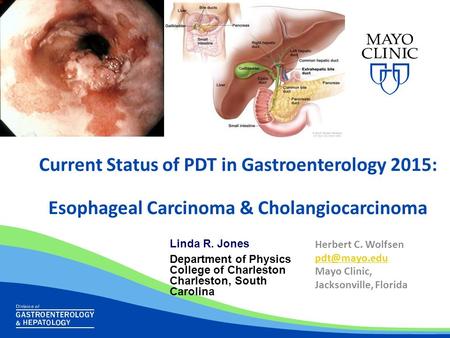 Current Status of PDT in Gastroenterology 2015: Esophageal Carcinoma & Cholangiocarcinoma Herbert C. Wolfsen Mayo Clinic, Jacksonville, Florida.