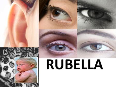 RUBELLA. WHAT IS RUBELLA A rash (small, fine pink spots) that starts on the face and spreads to the torso, then to the arms and legs with low fever. Rubella.