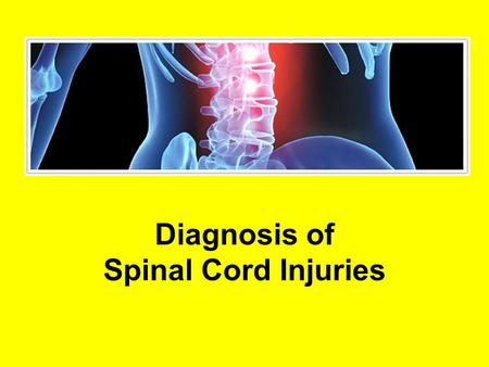 Diagnosis of Spinal Cord Injuries. Traumatic Spinal Cord Injury Immediate loss of strength Immediate numbness in legs and arms Level of injury can predict.