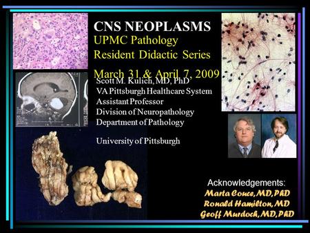 UPMC Pathology Resident Didactic Series March 31 & April 7, 2009 CNS NEOPLASMS Scott M. Kulich, MD, PhD VA Pittsburgh Healthcare System Assistant Professor.