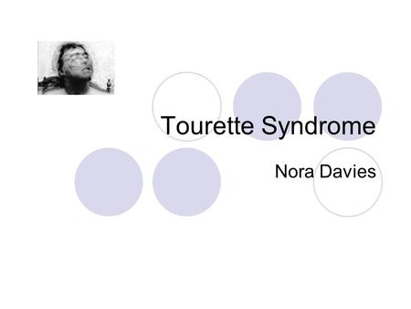 Tourette Syndrome Nora Davies. Introduction to Tourette A neurological disorder in which the subject suffers from repetitive involuntary movements or.