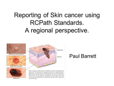 Reporting of Skin cancer using RCPath Standards. A regional perspective. Paul Barrett.