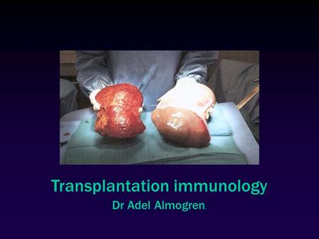 Transplantation immunology Dr Adel Almogren.. Transfusion vs. Transplantation  Transfusion  transfer of blood  Ab-mediated reactions  Transplantation.