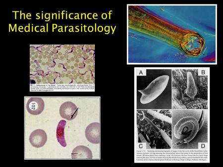 The significance of Medical Parasitology. Prevalent infections worldwide Significant morbidity & mortality Significant impact on economic & social development.