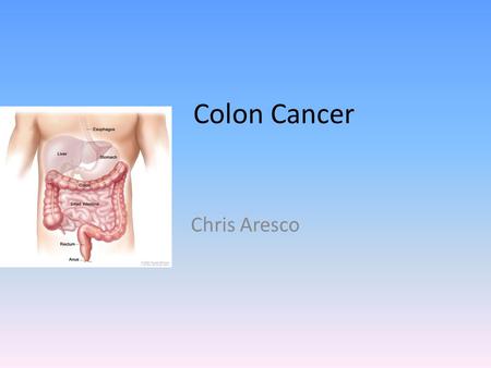 Colon Cancer Chris Aresco Statistics 51,848 people in the United States died of colon cancer in 2009 (26,806 men and 25,042 women) Colon cancer is not.