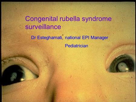 Congenital rubella syndrome surveillance Dr Esteghamati, national EPI Manager Pediatrician.