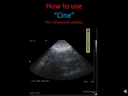 How to use “Cine” (For ultrasound studies) Questions or Issues? Call: PACS Team (757) 953 – 1162 PACS Duty Pager (757) 314 - 0519 Questions or Issues?