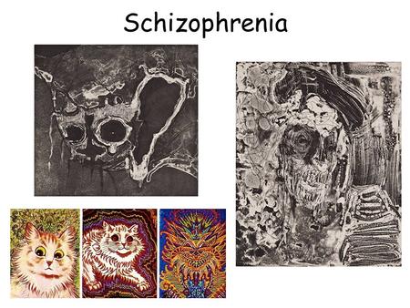 Schizophrenia Schizophrenic Disorders Literally means “split mind” About 1 in every 100 people are diagnosed with schizophrenia. General onset is between.