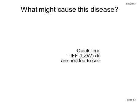Lesson 3 Slide 3.1 What might cause this disease?.