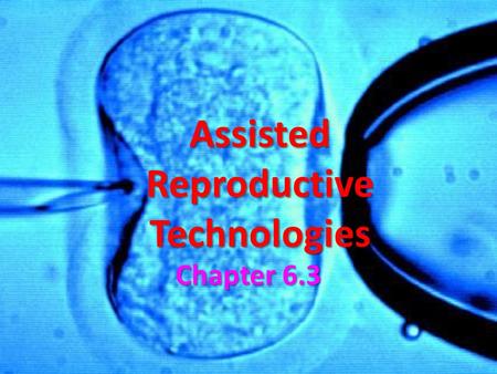 Assisted Reproductive Technologies Chapter 6.3. Assisted Reproductive Technologies Many couples can be infertile due to complications related to the reproductive.