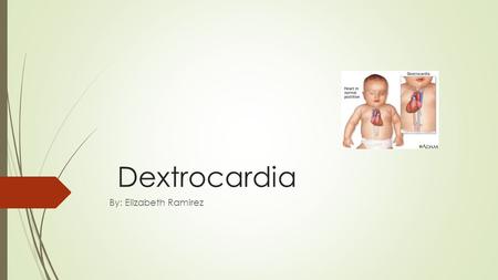 Dextrocardia By: Elizabeth Ramirez. What are genetic disorders?  Genetic disorders are problems that happen in the DNA. A part of the DNA was not reproduce.