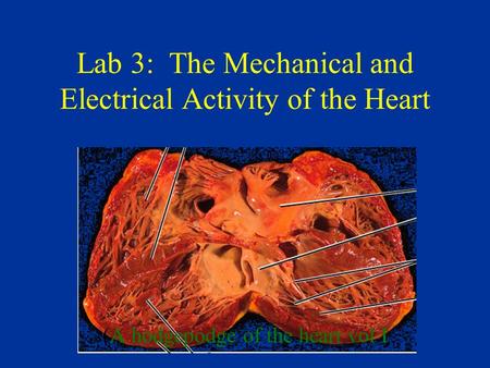 Lab 3: The Mechanical and Electrical Activity of the Heart (A hodgepodge of the heart vol I.