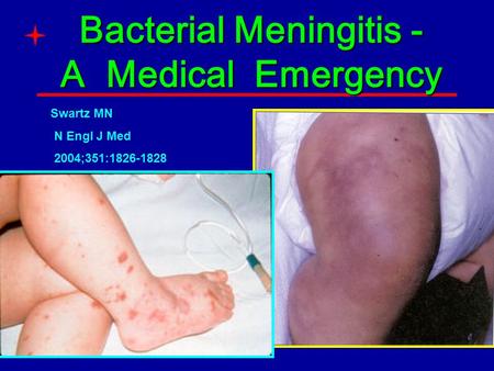 Bacterial Meningitis - A Medical Emergency Swartz MN N Engl J Med 2004;351:1826-1828.