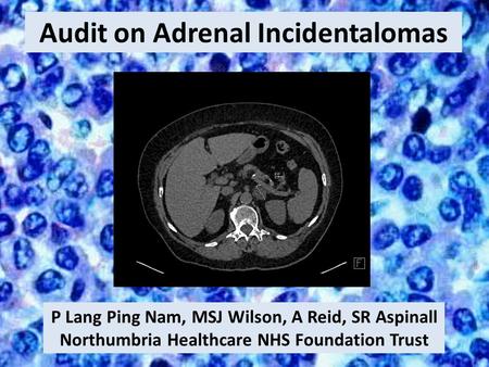 Audit on Adrenal Incidentalomas