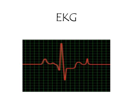EKG. Objective: The student will become familiar with an EKG and how it works to record the electrical activity of the heart The student will become familiar.