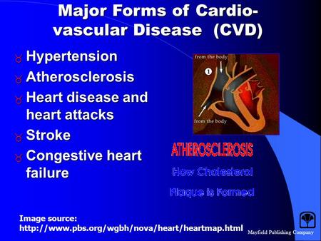 Mayfield Publishing Company Major Forms of Cardio- vascular Disease (CVD)  Hypertension  Atherosclerosis  Heart disease and heart attacks  Stroke.